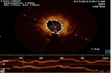 A matemática na procura de respostas no âmbito da cardiologia